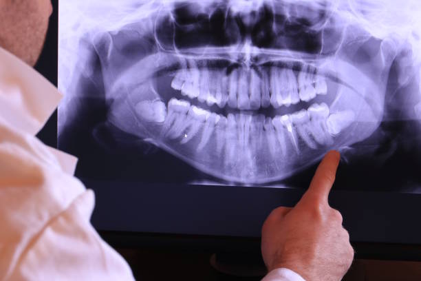 Best Emergency Gum Treatment in Griggsvle, IL