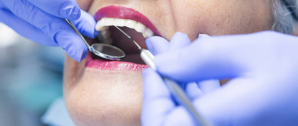 Best Emergency Treatment for Dental Infections or Abscesses in Griggsvle, IL