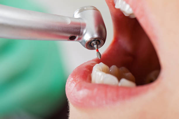 Best Weekend Emergency Dentist in Griggsvle, IL